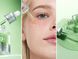 Успокаивающая сыворотка Anua Azelaic Acid 10 Hyaluron Redness Soothing Serum, 30 мл &mdash; фото 4