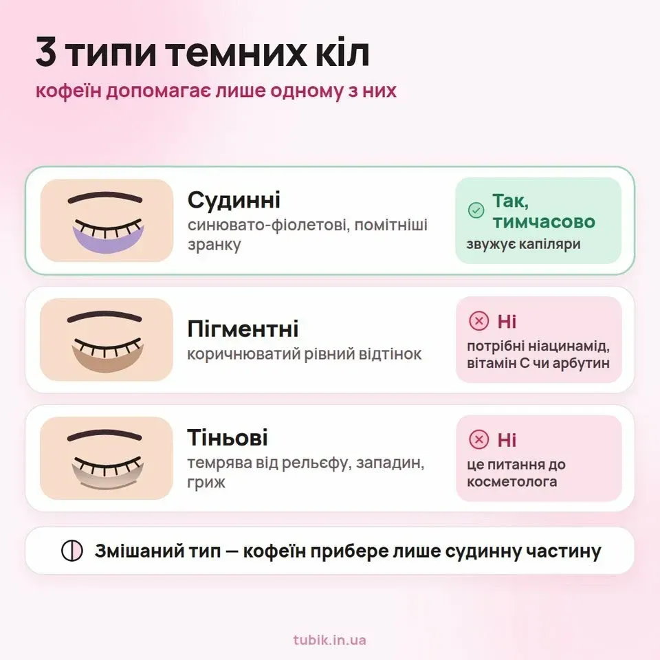 Три типи темних кіл під очима: з яким допоможе кофеїн