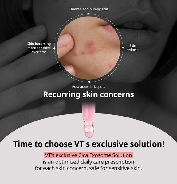 Азелаїнова ампула з екзосомами VT Cosmetics A1 Clear Balance Azelaic Ampoule, 30 мл &mdash; фото