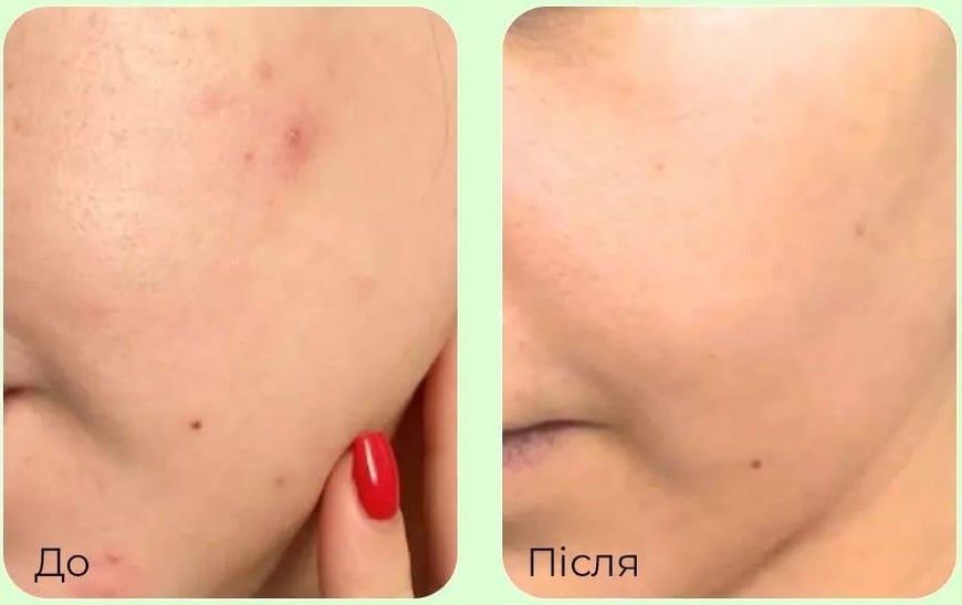Успокаивающая ампульная сыворотка с PDRN и экзосомами Medi-Peel Young Cica PDRN Trouble Soothing Ampoule, 50 мл &mdash; фото