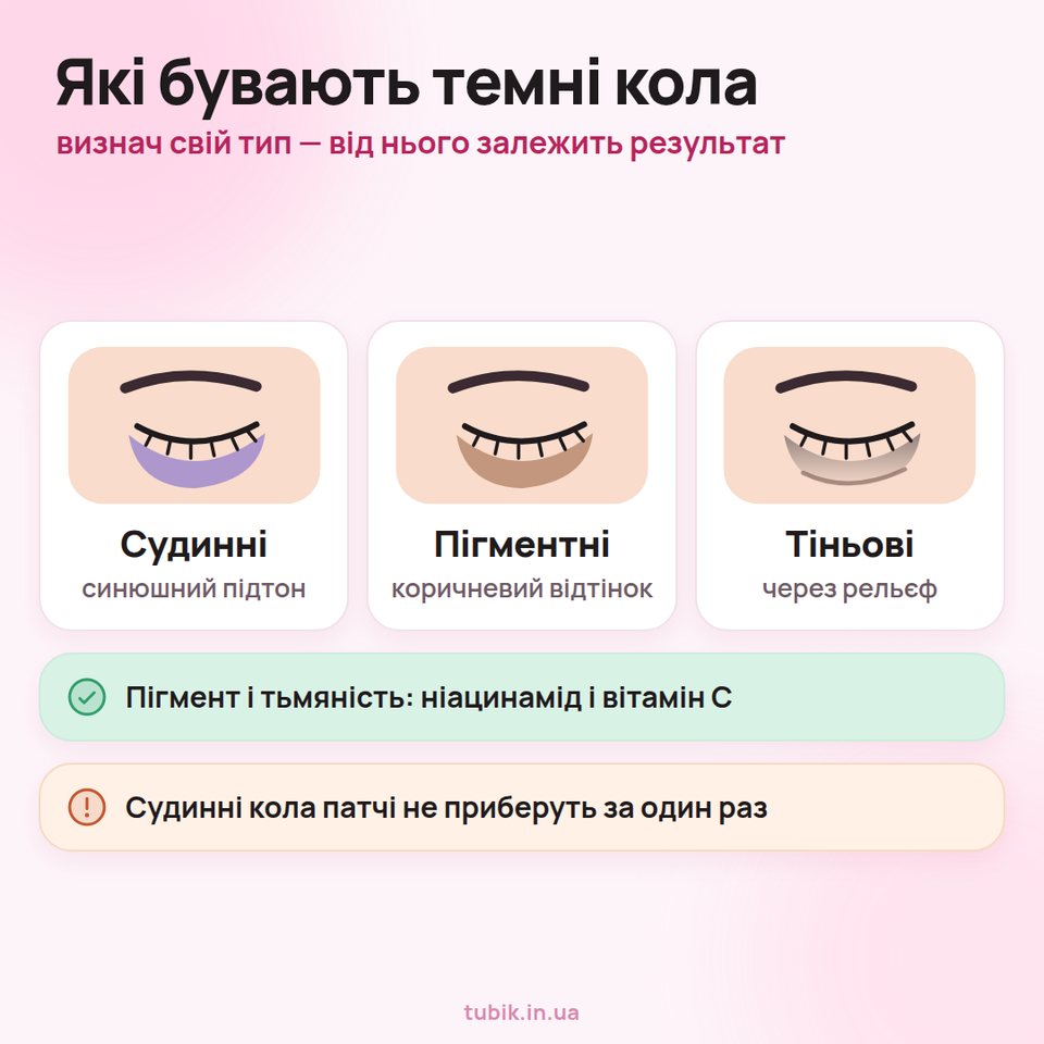 Три типи темних кіл під очима: судинні (синюшний підтон), пігментні (коричневий відтінок) і тіньові (через рельєф)